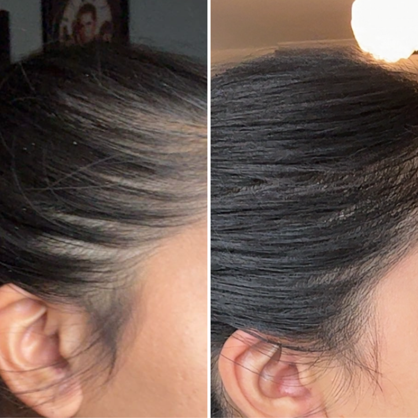 Before and after comparison of hair growht 